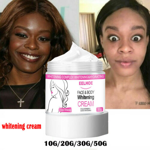 Permanent Skin Bleaching Oil In Smedjebacken Municipality in Sweden, Skin Whitening Products In Kincaid City in Kansas Call ☏ +27710732372 Scars And Stretch Marks Removal Cream In Rustenburg, Pimple Treatment In Louis Trichardt South Africa