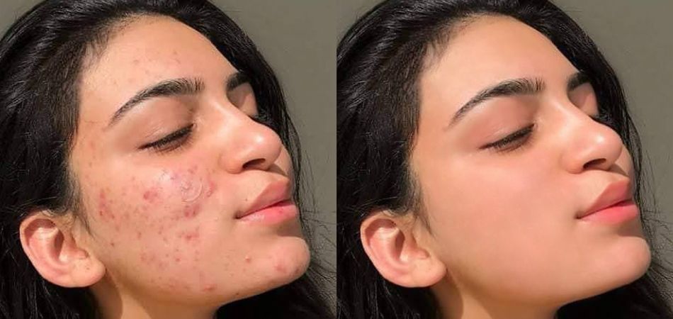 Photo retouching service
